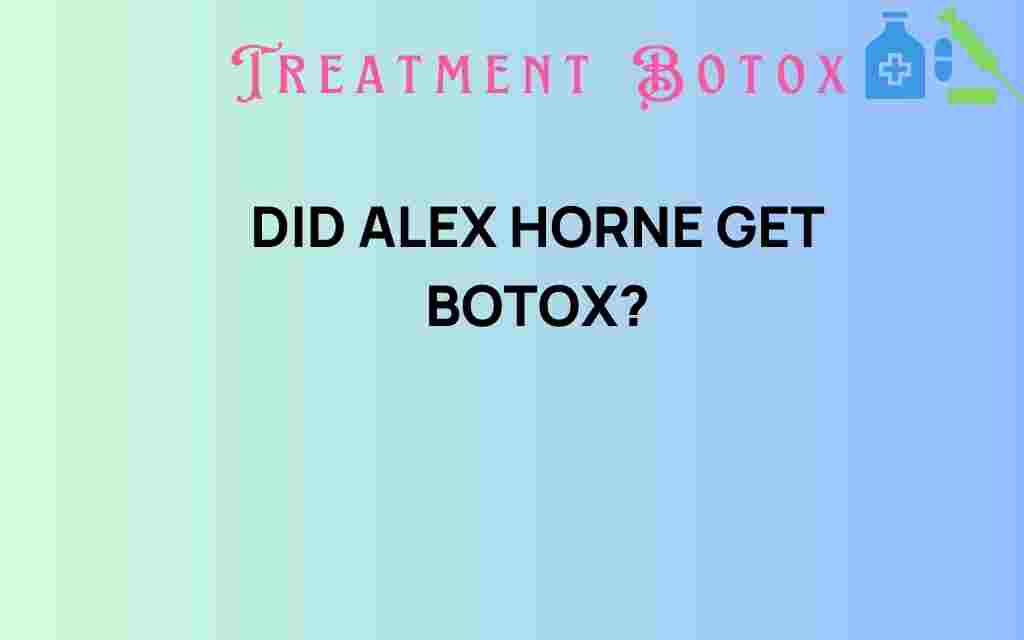 did-alex-horne-get-botox